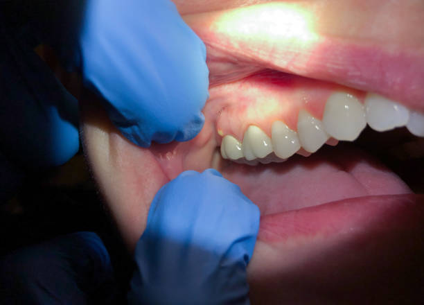 Best Emergency Dentist for Special Needs Patients in Keasbey, NJ